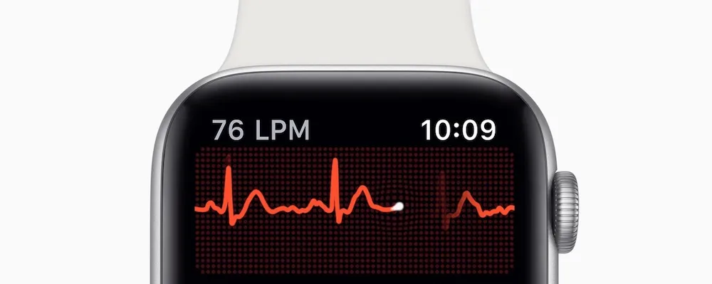 Close-up of an Apple Watch screen showing the electrocardiogram (ECG) app in operation, with the waveform graph in red and indicating 76 BPM.